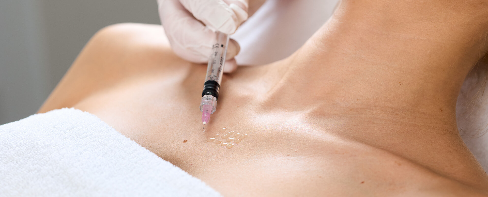 Mesotherapie am Dekollete