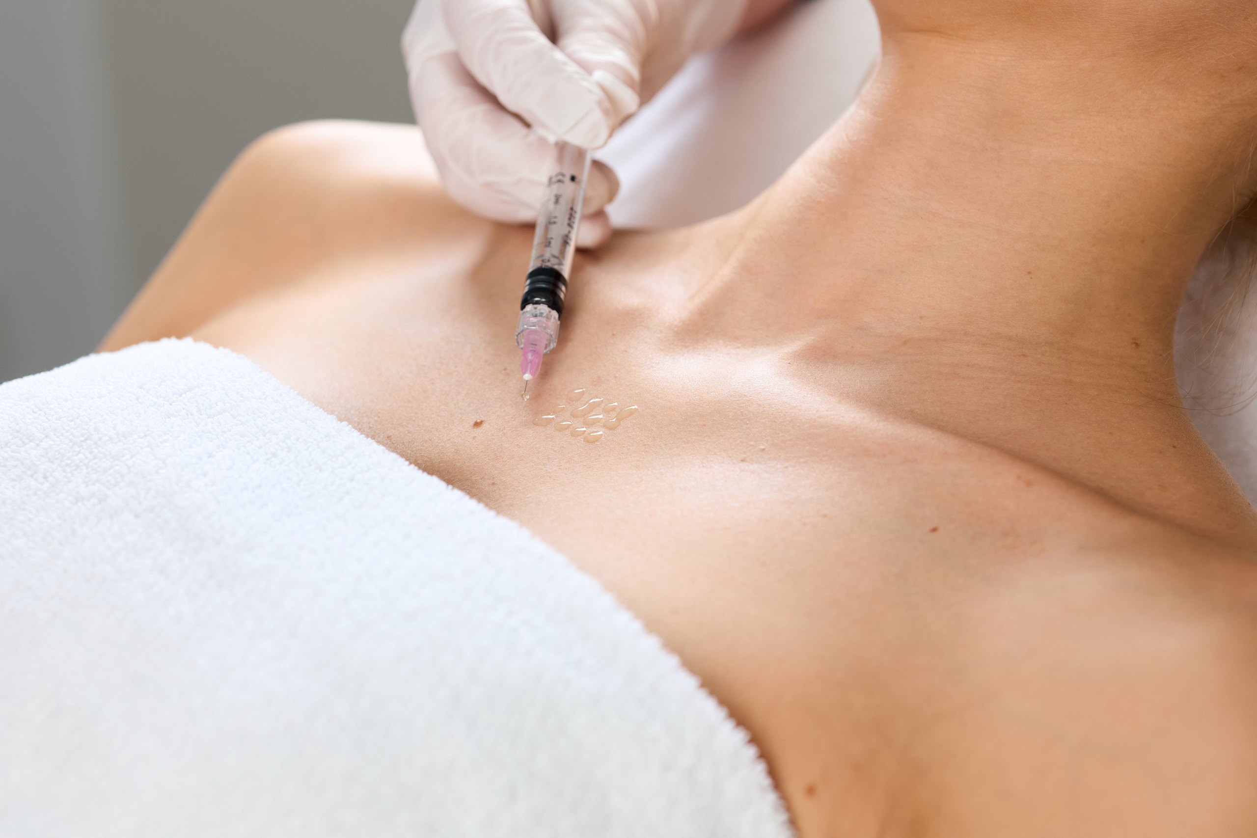 Ärztin der Hamburg Dermatologie setzt eine Injektion im Dekolleté-Bereich