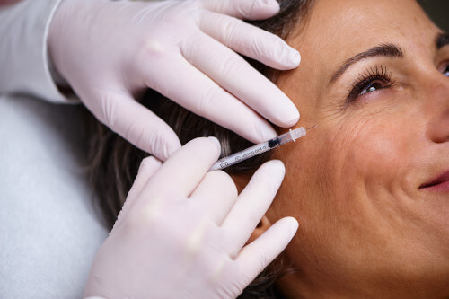 Faltenbehandlung mittels Botox Injektion