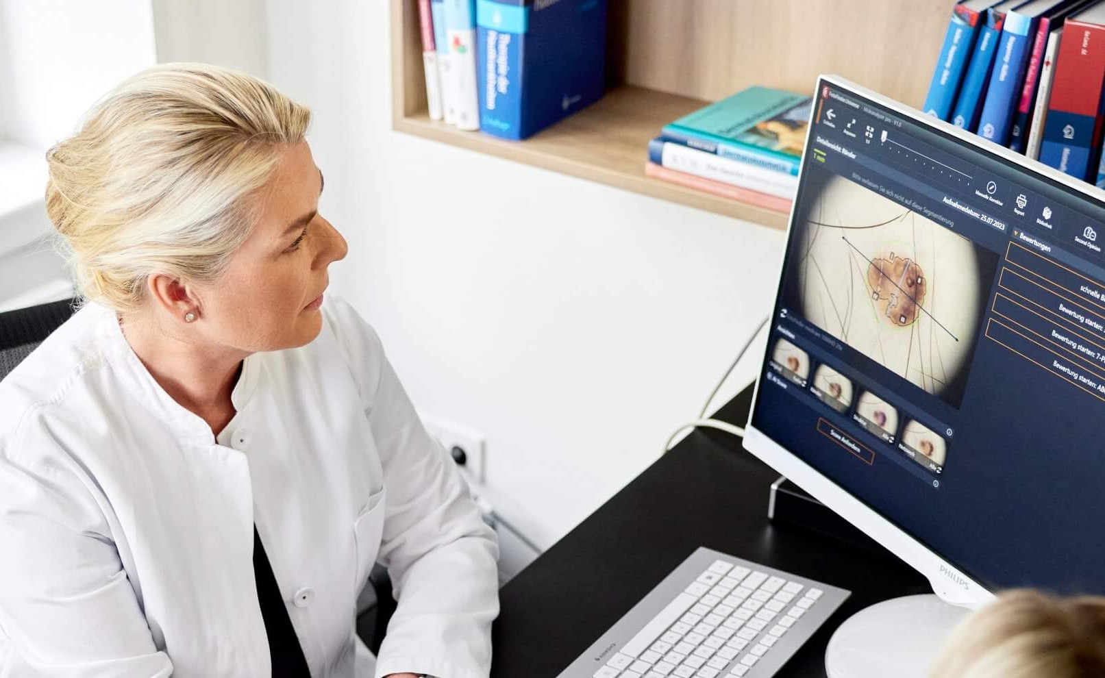 Dr. med. Daniela Wiebels beurteilt ein Muttermal am Bildschirm der digitalen Auflichtmikroskopie