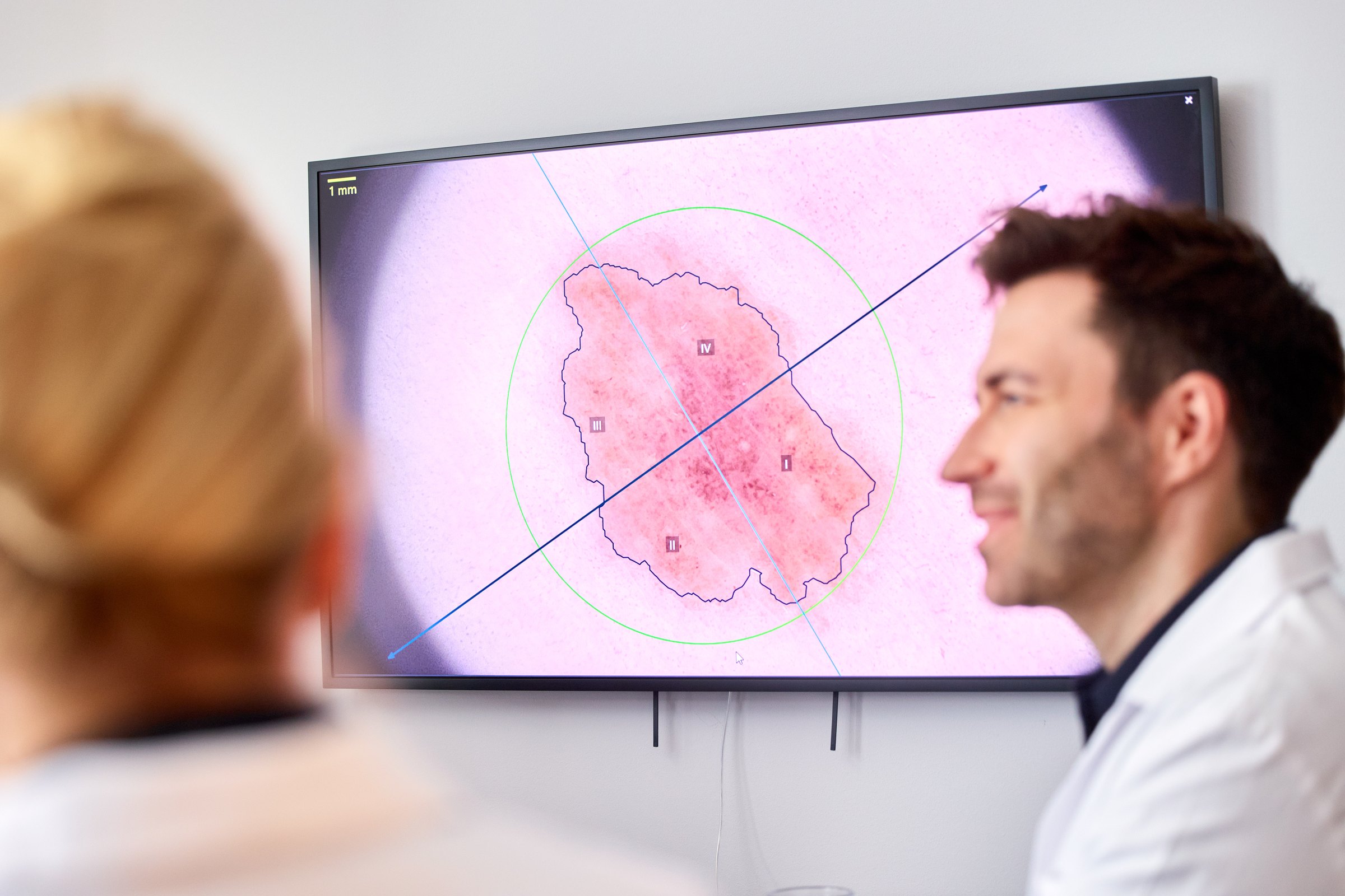 Arzt der Hamburg Dermatologie vor einem vergrößerten Hautbild auf dem Monitor