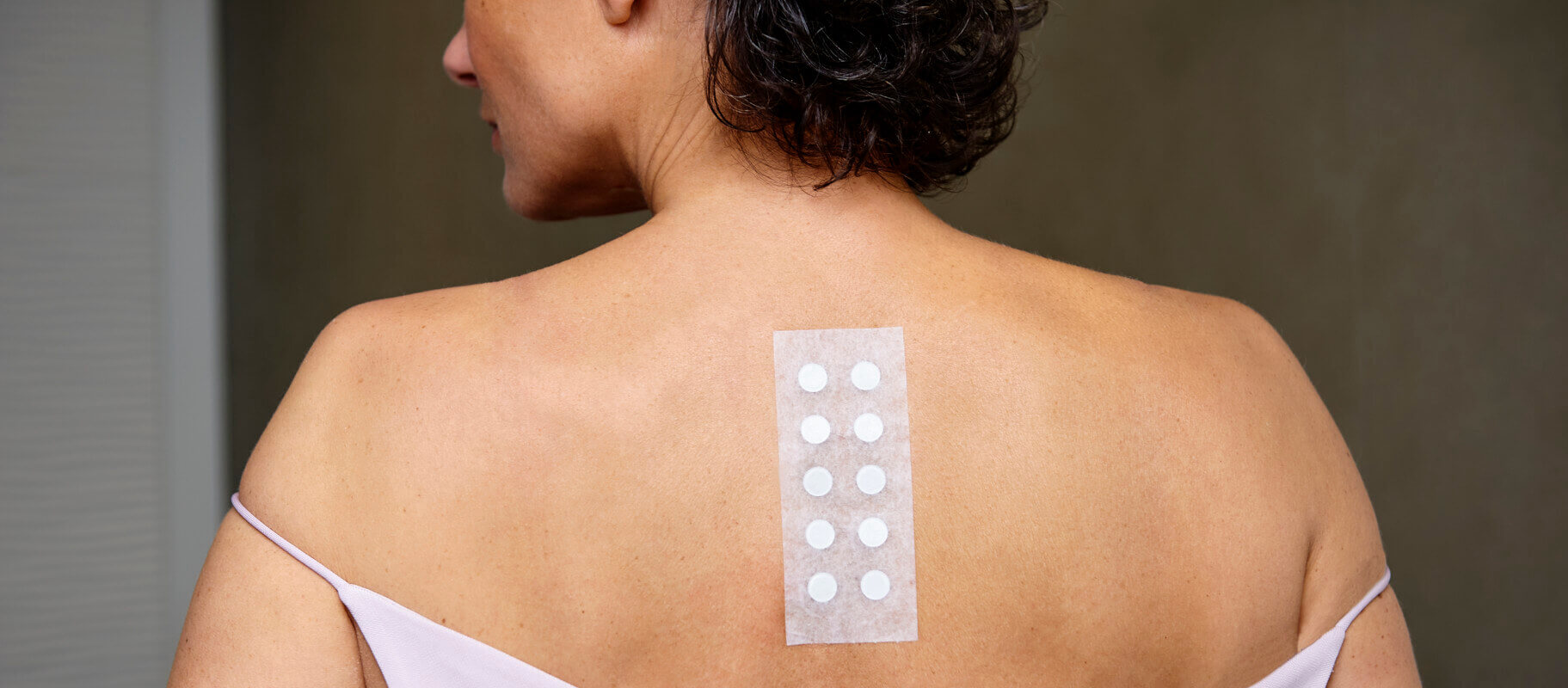 Pflastertest auf dem Rücken einer Patientin