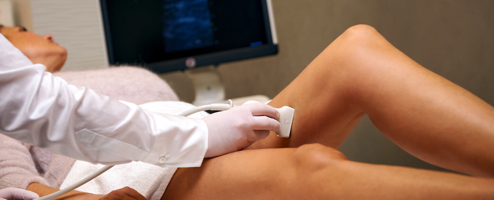 Ultraschalluntersuchung der Beinvenen
